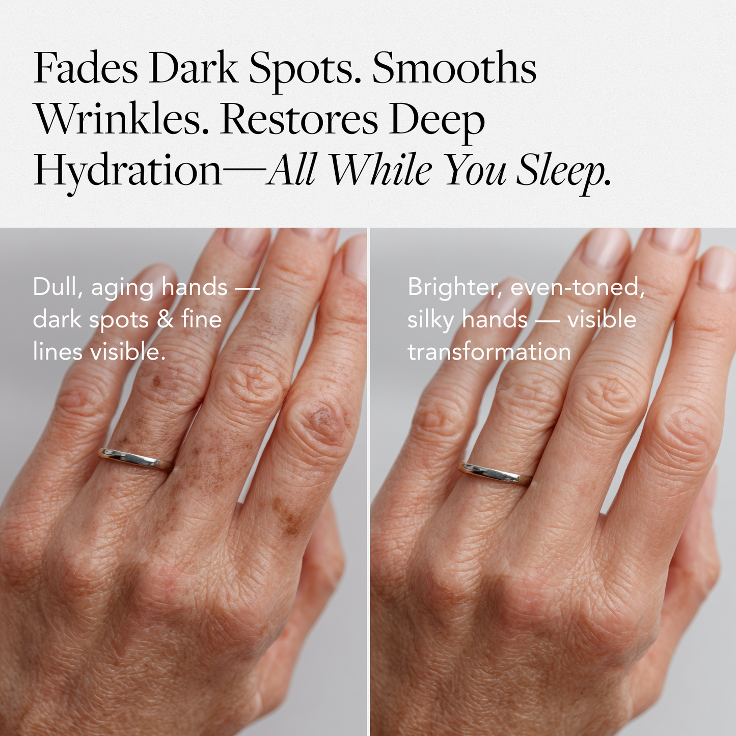 Dark Spot Correcting Hand Treatment™